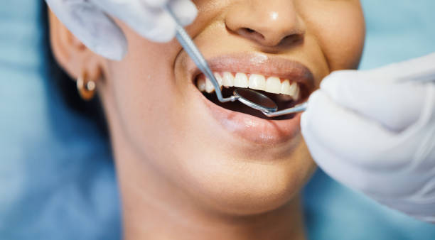 Best Knocked-Out Tooth Emergency  in Groveport, OH